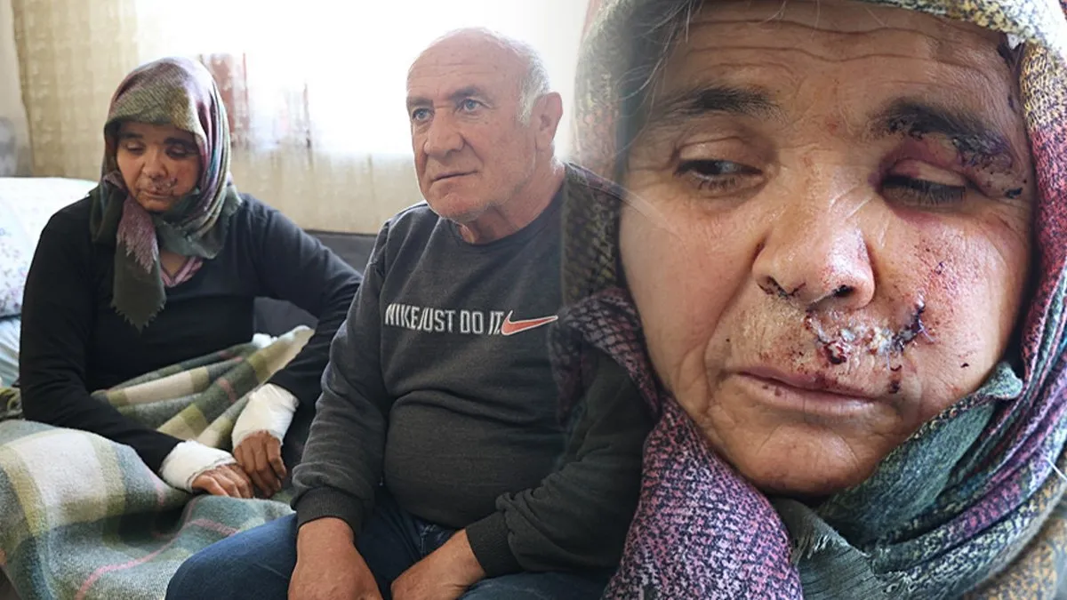 Aksaray’da yaşlı çift ziyaret için gittikleri kızlarının evinde kabusu yaşadı: Eşim olmasaydı beni yiyecekti!